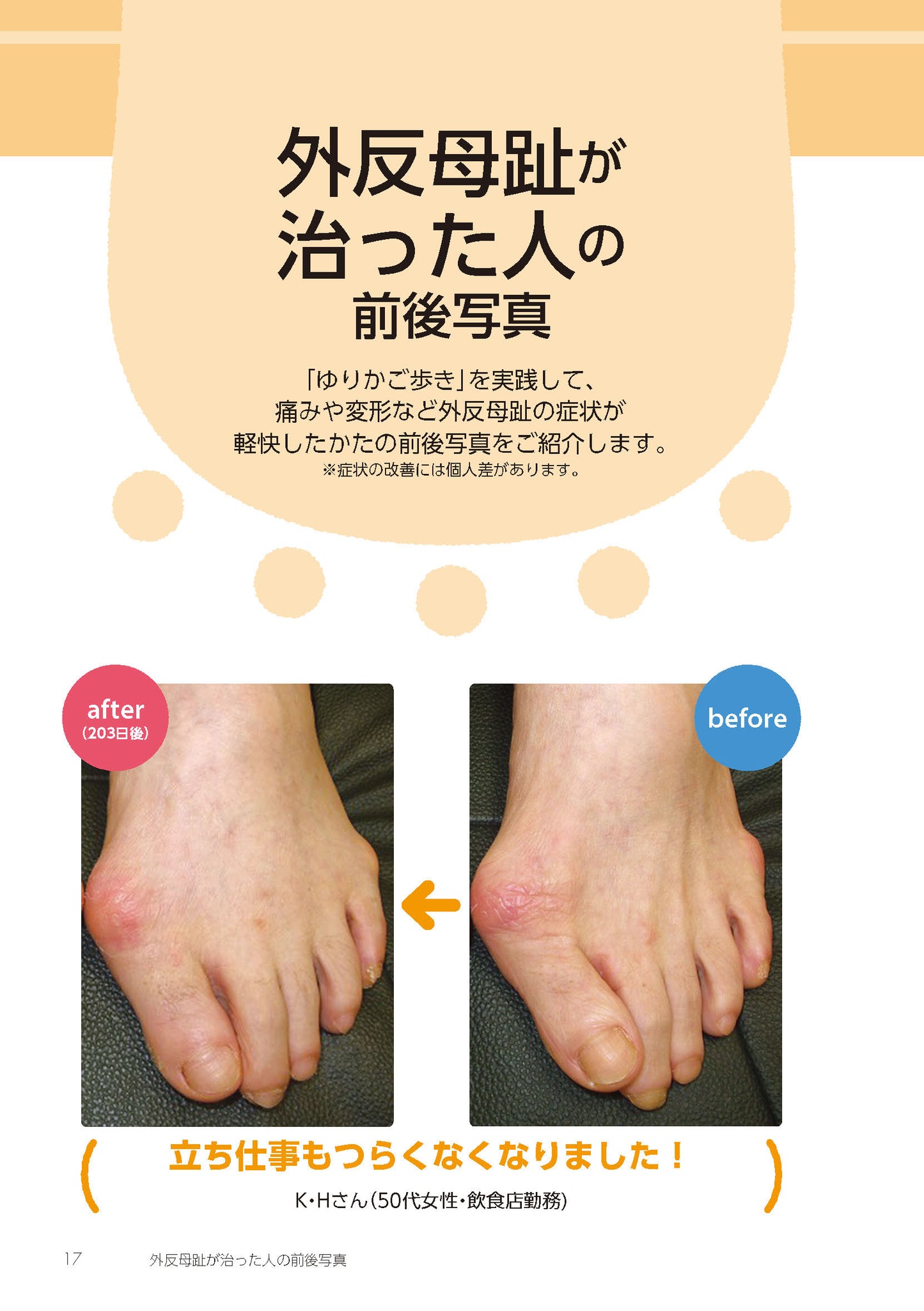 【書籍】外反母趾が改善!ゆりかご歩き(M1858)