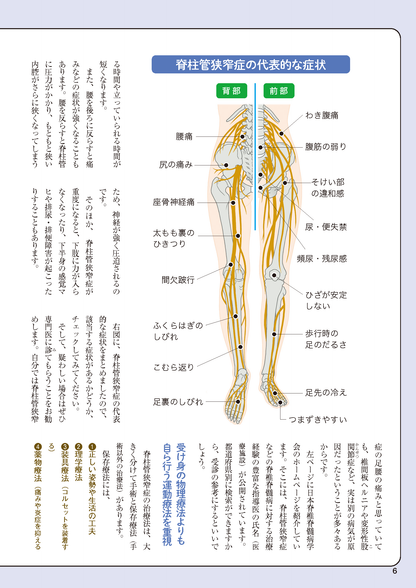 【書籍】脊柱管狭窄症 名医が教える特効療法 新装版(M1714)