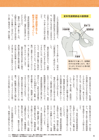 【書籍】股関節痛 名医が教える最高の治し方 新装版(M1802)