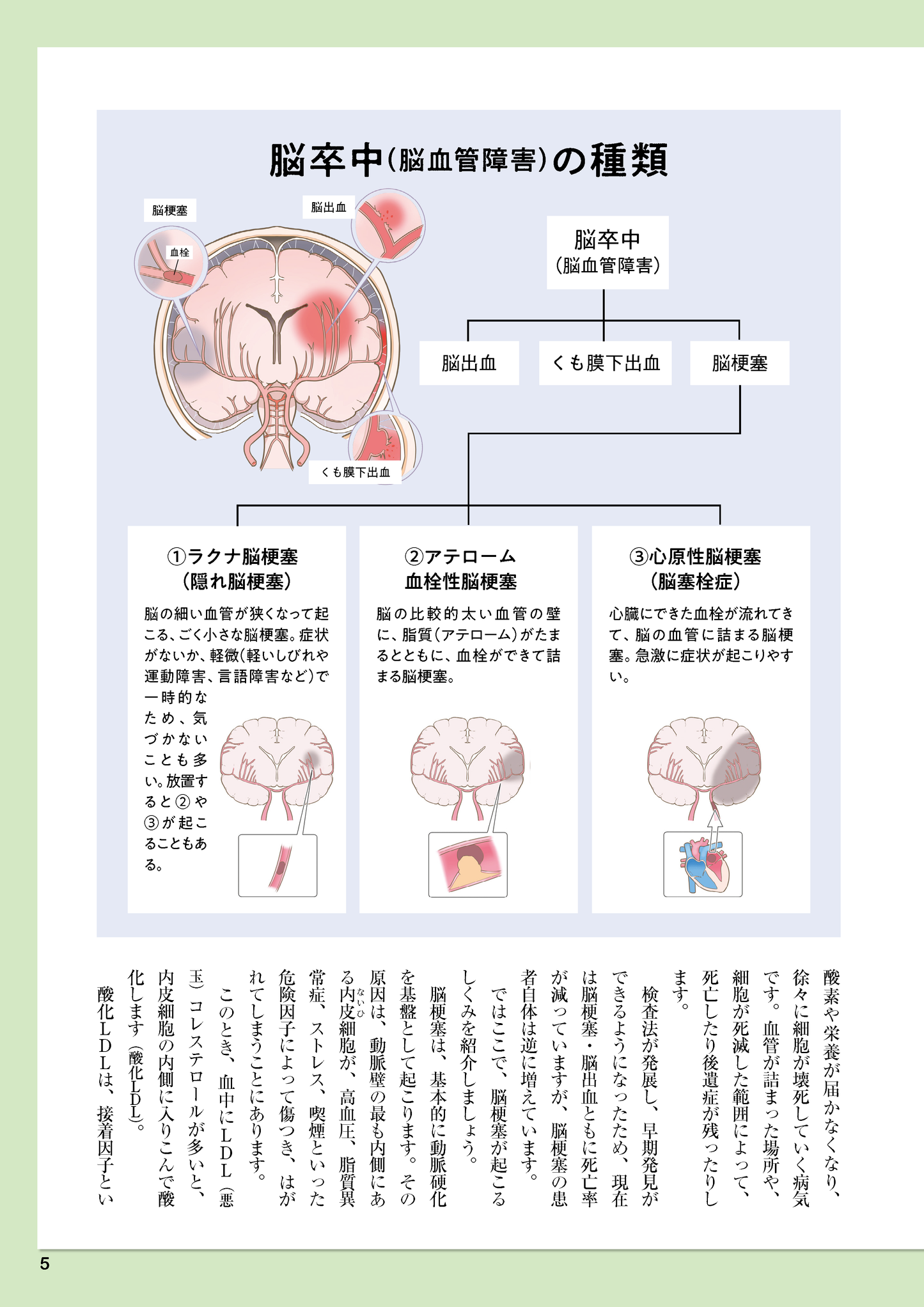 【書籍】脳梗塞 自力で防ぐ血管強化術 新装版(M1810)