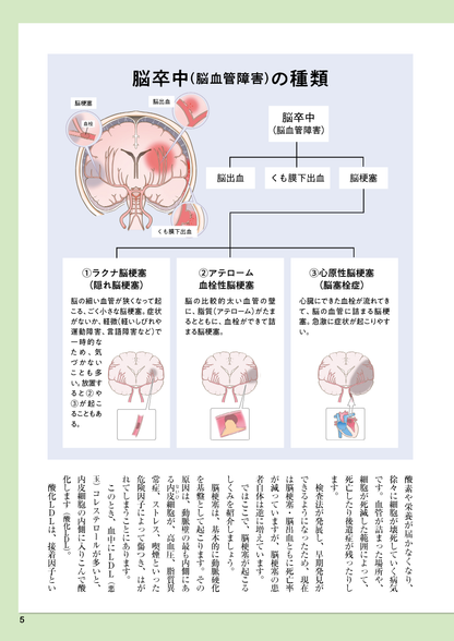 【書籍】脳梗塞 自力で防ぐ血管強化術 新装版(M1810)
