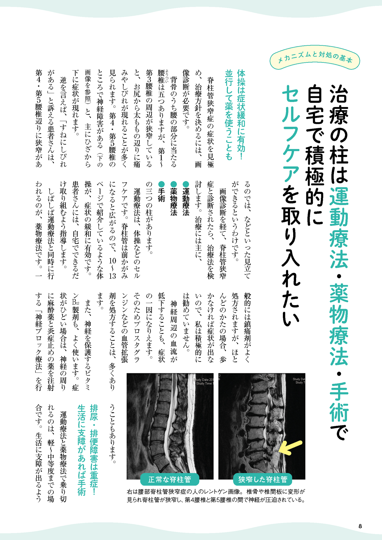 【書籍】脊柱管狭窄症 痛み・しびれを撃退する特効ケア(M1818)