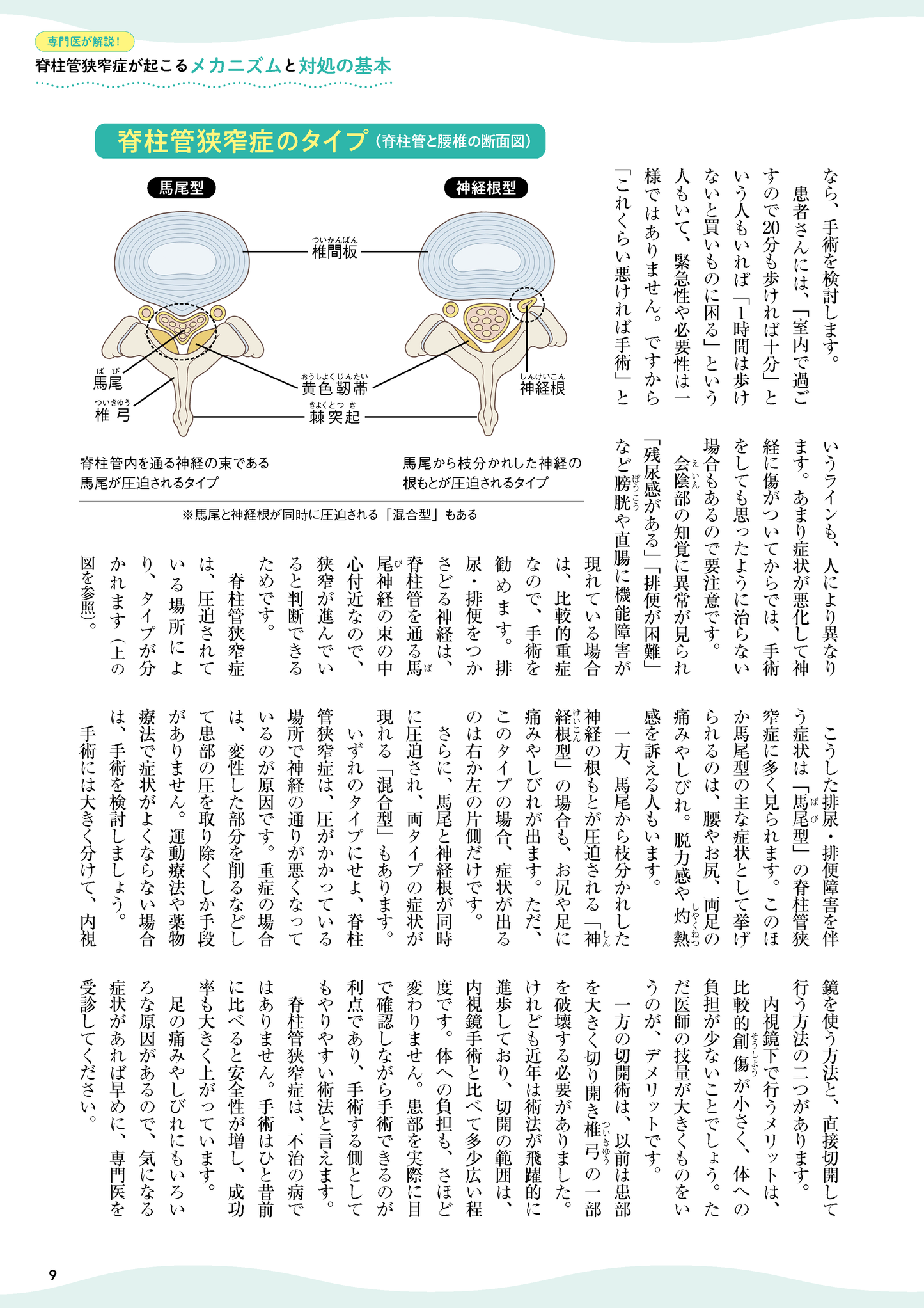 【書籍】脊柱管狭窄症 痛み・しびれを撃退する特効ケア(M1818)