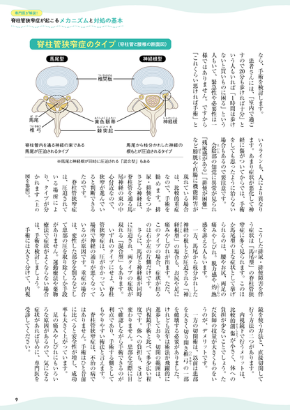 【書籍】脊柱管狭窄症 痛み・しびれを撃退する特効ケア(M1818)