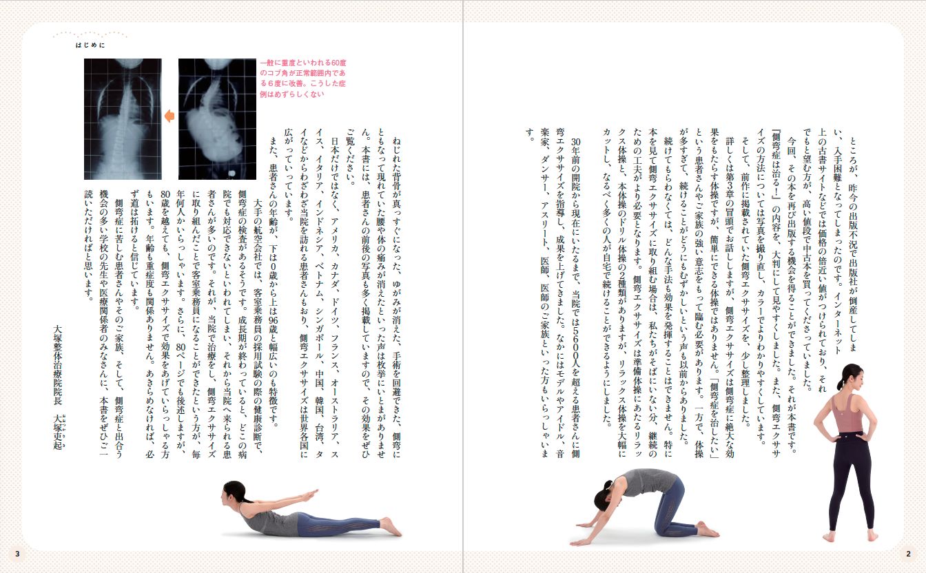 【書籍】側弯症は治る！5600人のゆがみに効いた驚異のエクササイズ(M1843)